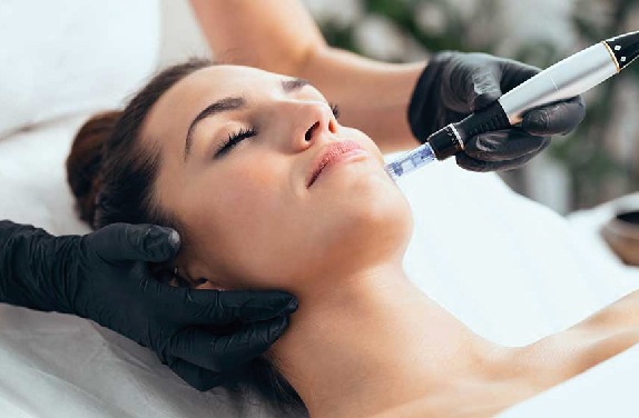 ADN de Salmón con Dermapen